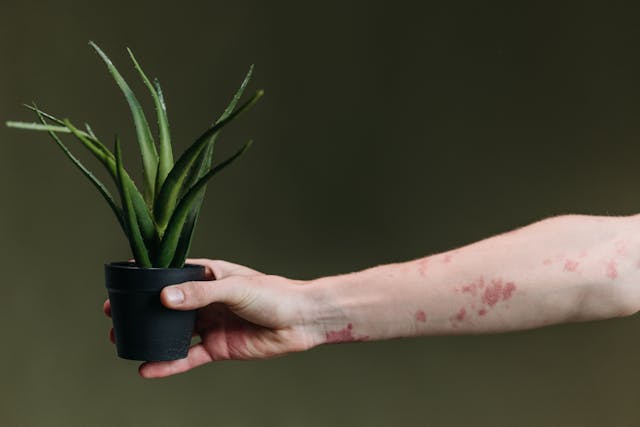 Skin-Related Reactions Energy Healing